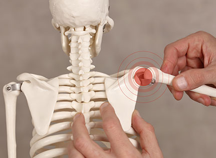 know-more-about-Shoulder Replacement-treatment-in-Delhi