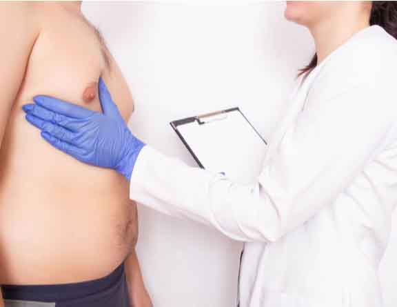Physical examination for Gynecomastia in delhi