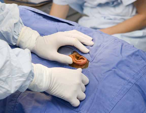 Doctors performing stapedectomy in mumbai