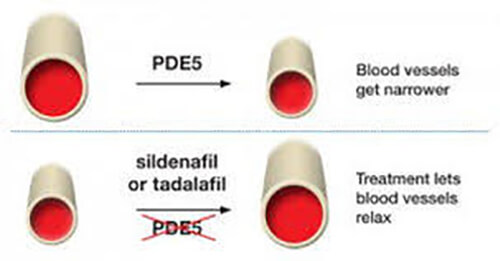 surgical therapies for BPH