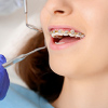 Female getting dental braces at a dentist