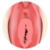 Illustration of a hymen and vagina after hymenoplasty surgery 