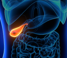 3-D illustration of gallbladder with a stone like figure in the gallbladder, depicting gallstones