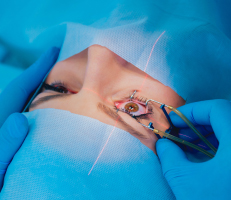 Female patient undergoing LASIK eye surgery