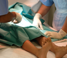 Male lying on surgical bed, showing the concept of stapler or ZSR circumcision