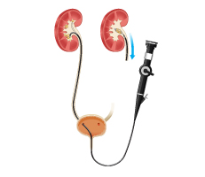 Most Advanced Urology Clinic with highly experienced urologist