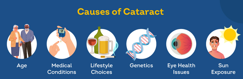 causes of cataract