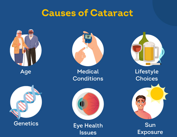 causes of cataract