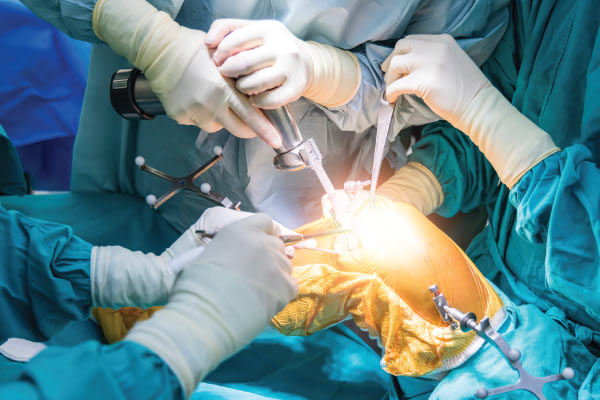 Doctor examining patient's knee after knee replacement surgery