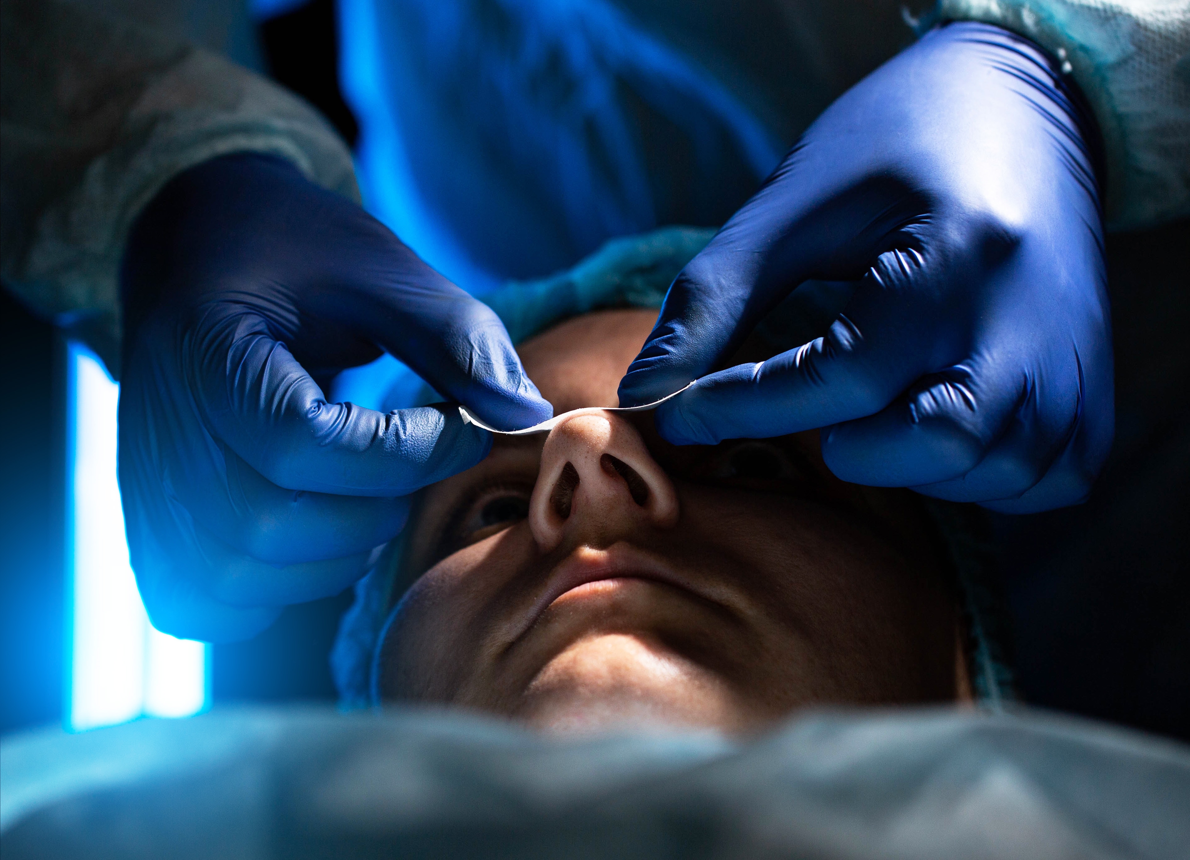 Doctors examining deviated septum before septoplasty surgery