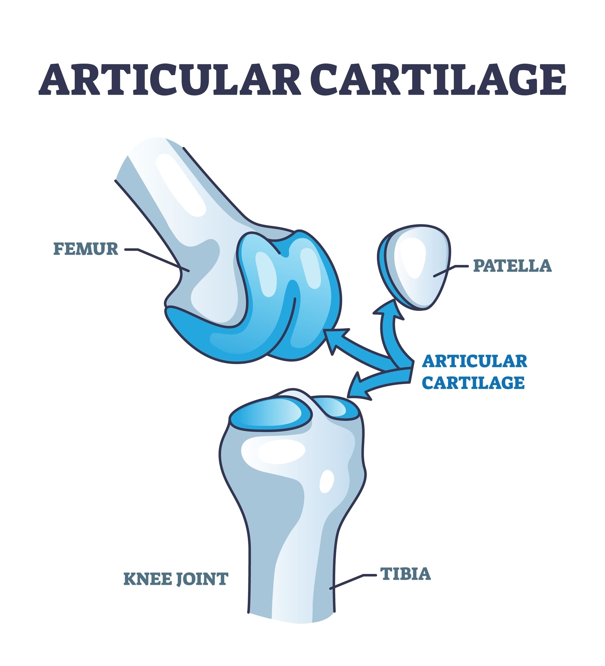 knee-cartilage-repair