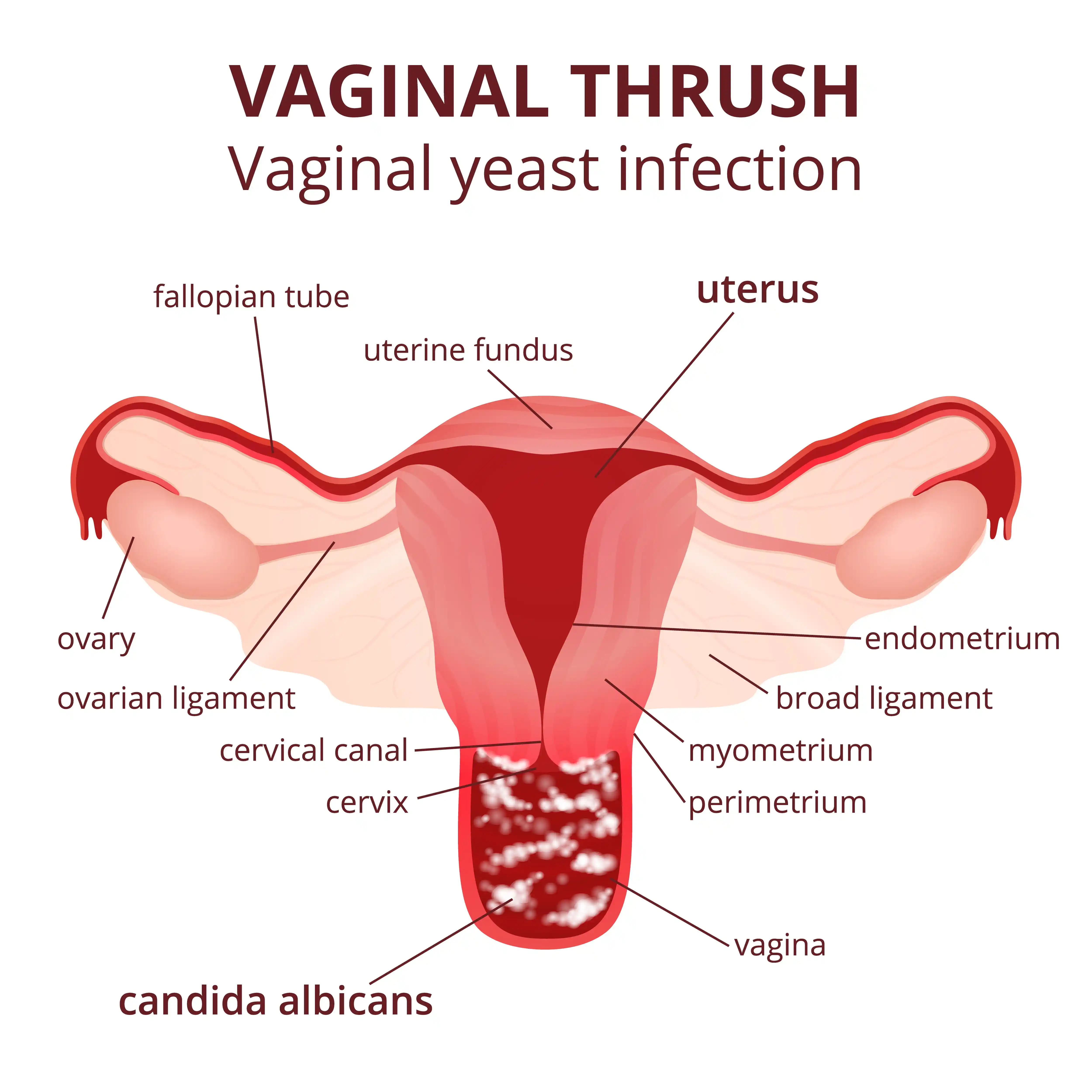 vaginal-itching