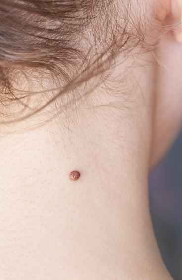 Overview of Dark Neck