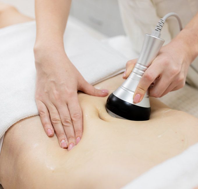 Cool Sculpting Fat Loss Treatment Journey