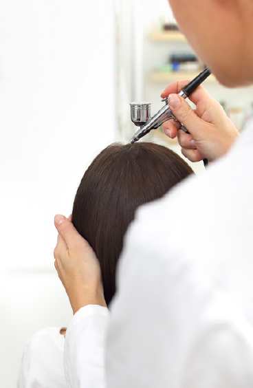 Overview of Dandruff