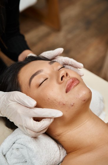 Overview of Acne Treatment