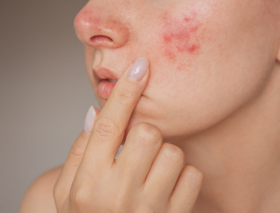 diseaseImg