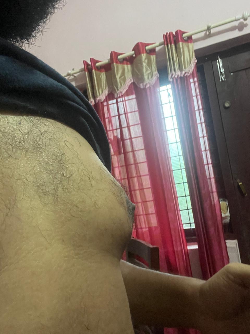 Side angle of male torso showing gynecomastia with sagging breast tissue