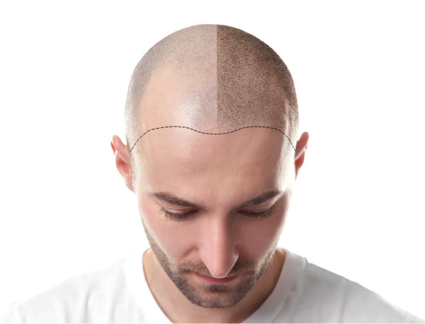 Treatment Face Areas