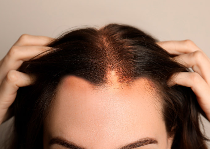 Before treatment 2
