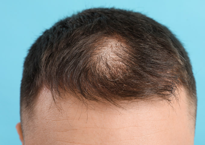 Before treatment 1