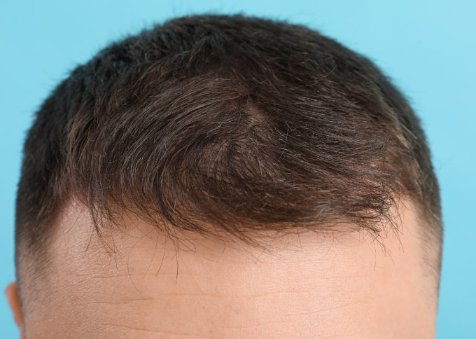 After treatment 1