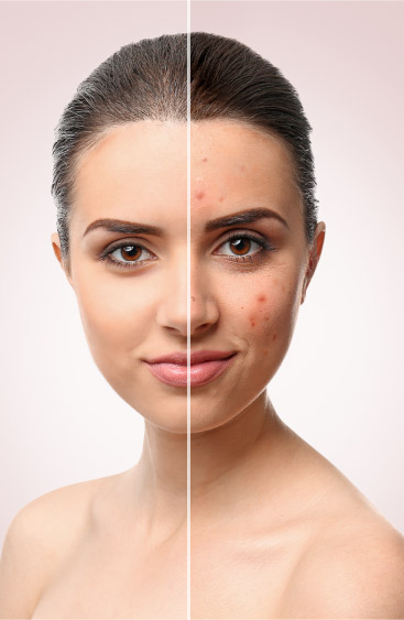 Overview of Scar Removal