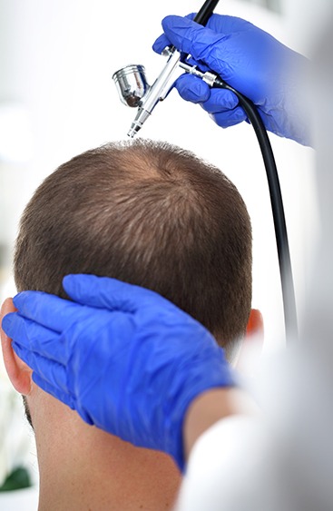 Overview of oxygen scalp