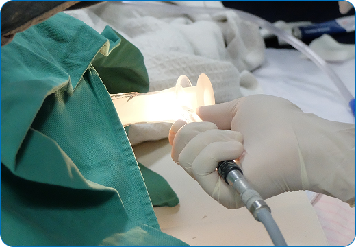 Medical diagnosis procedure for piles treatment