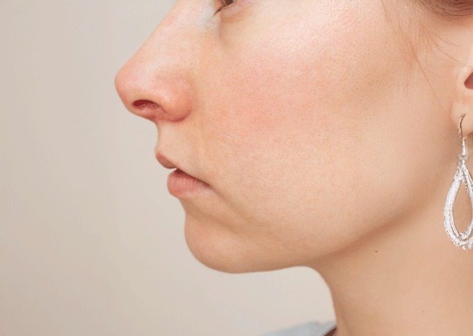 After treatment 1