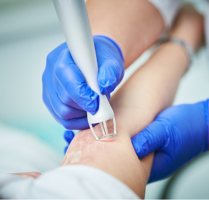 Scar Removal Journey