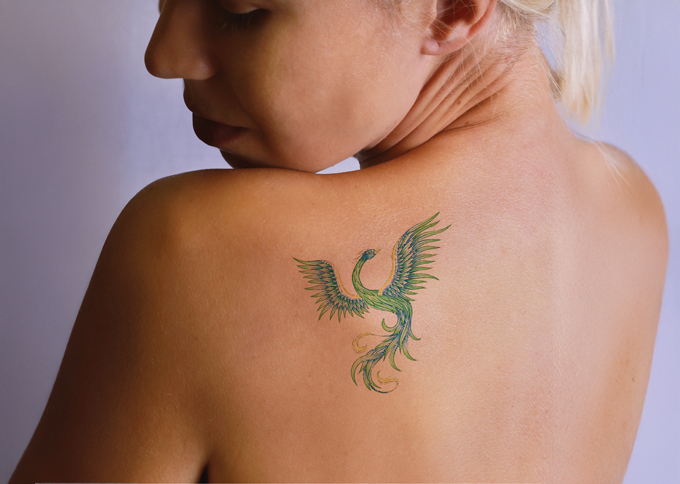 Before treatment 1