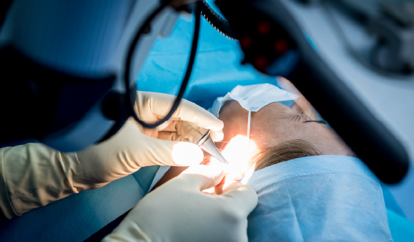 Doctors examining deviated septum before septoplasty surgery