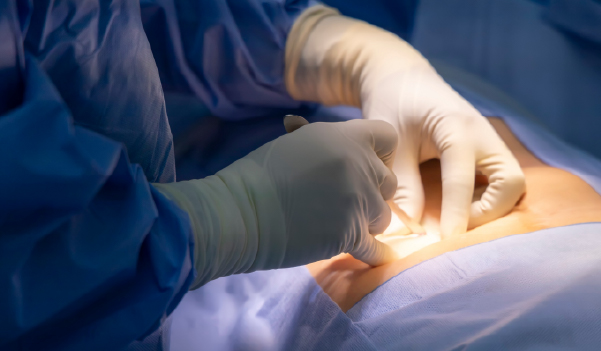 Doctor examining stomach of patient with appendicitis pain