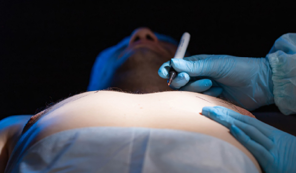 Physical examination for Gynecomastia