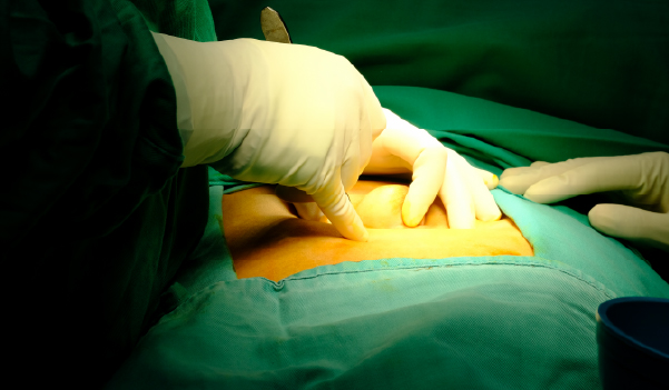Doctor touching the stomach area for examining Uterine Fibroid in pali