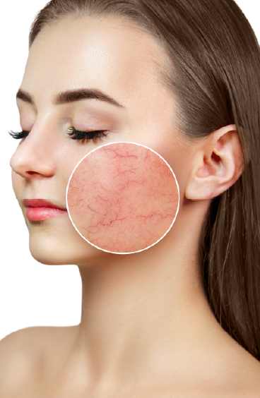 Overview of Vascular Lesion