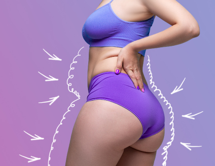 know-more-about-Autologous Fat Augmentation-treatment-in-Delhi