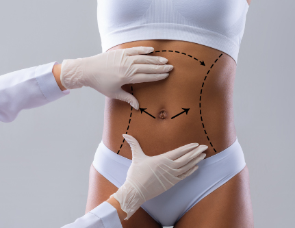 know-more-about-Body Threadlift-treatment-in-Delhi