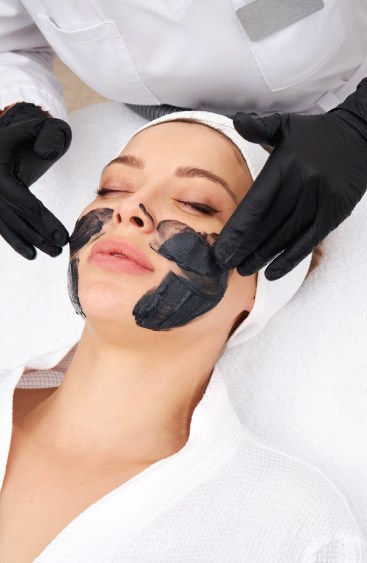Overview of Carbon Laser Peel 