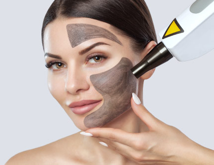 know-more-about-Carbon Laser Peel-treatment-in-Delhi