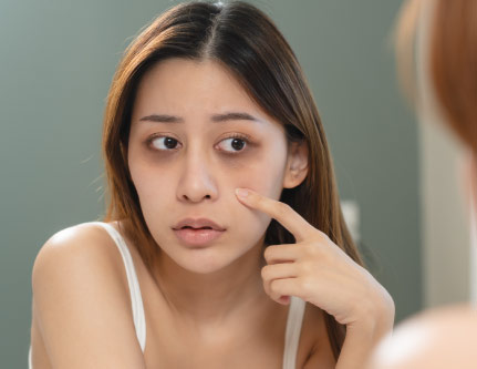 know-more-about-Dark Circle-treatment-in-Delhi