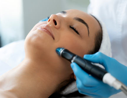 derma pen treatment