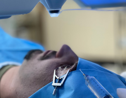 excimer laser treatment