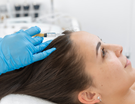 Hair prp treatment