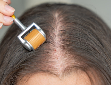 hair growth roller
