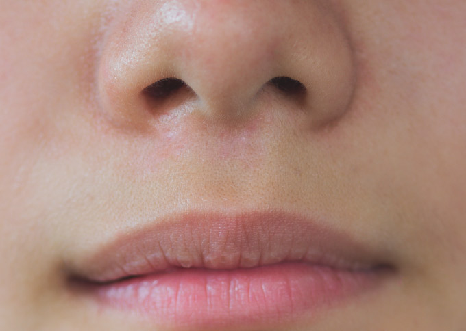 After treatment 1