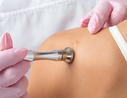 keloid scar treatment