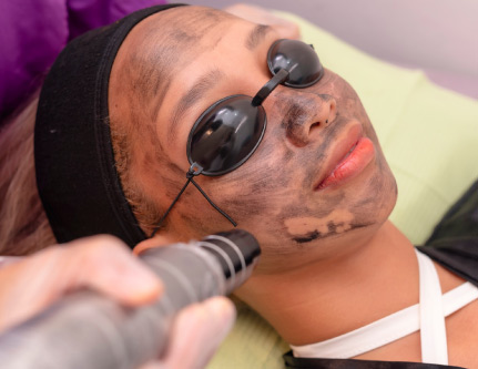 laser facial toning Treatment