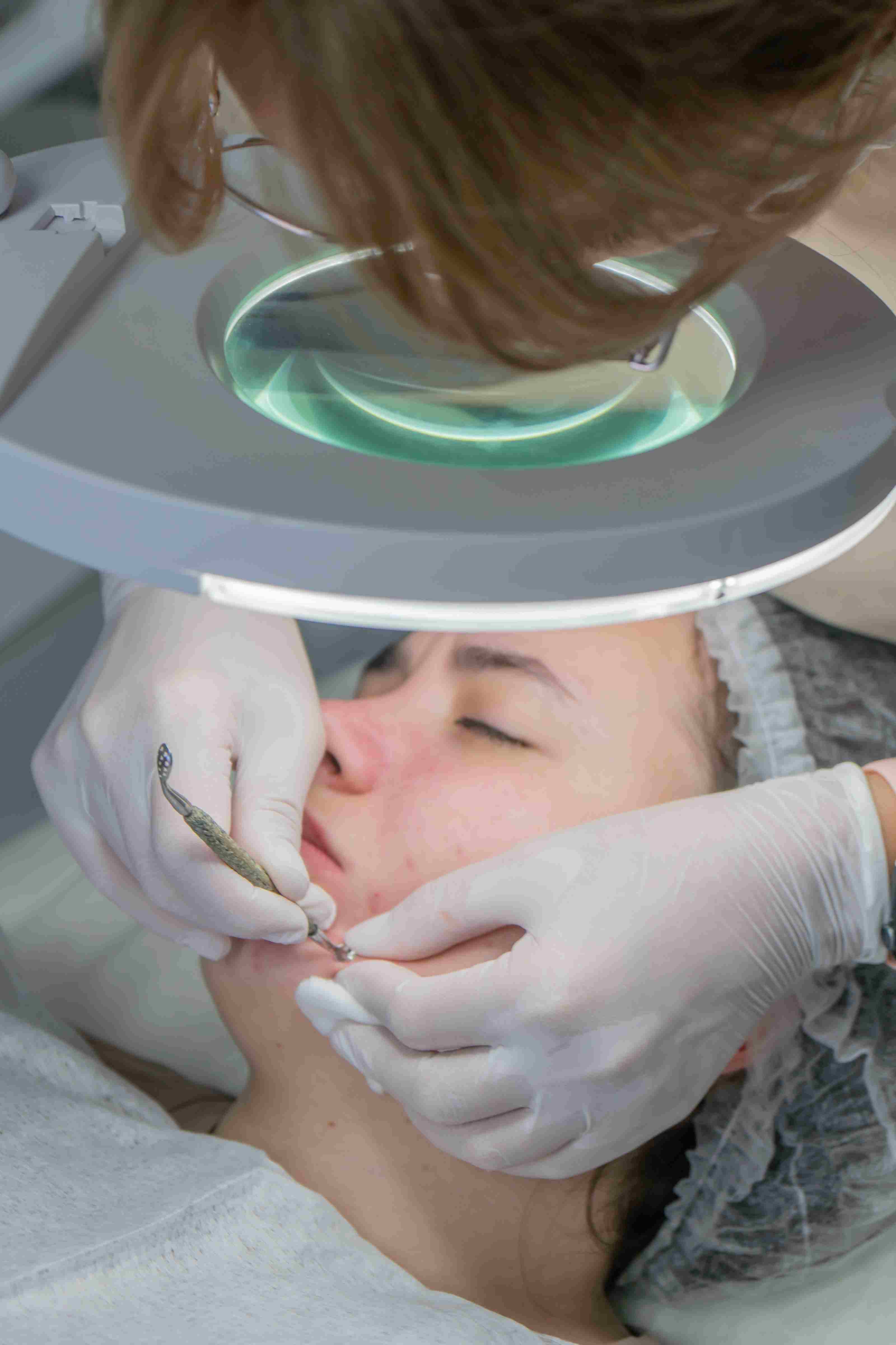 Overview of Laser hair removal